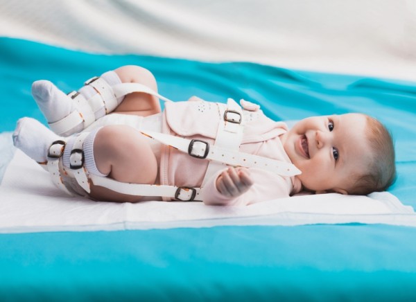 Baby with hip dysplasia wearing a harness to hold their hips in a stable position