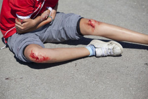 Skin cuts and grazes on child who has fallen over on road