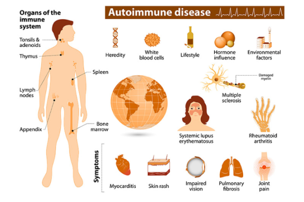 Information about autoimmune diseases