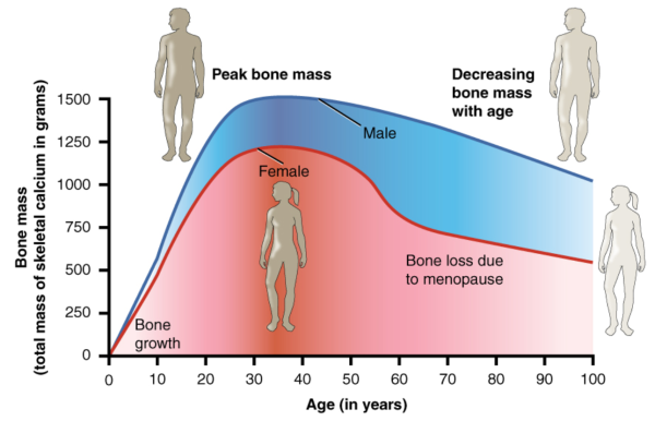 Loss of bone mass with ageing graphed